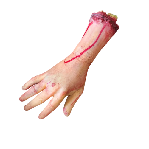 Bloody hand